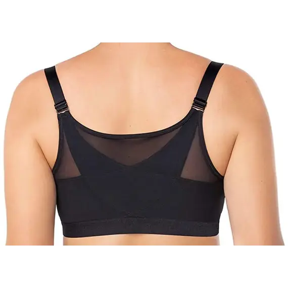 חזייה לאחר ניתוח